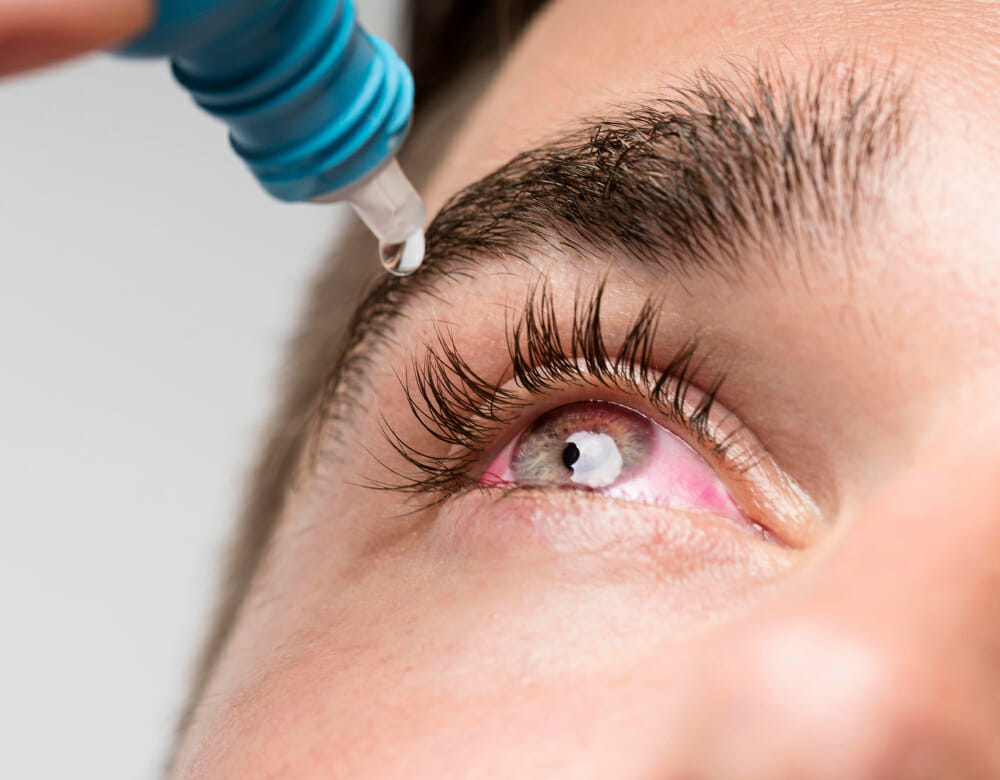 How Does an Eye Doctor Test For Dry Eye? in Bellflower