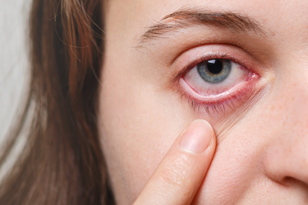 Causes of Gritty Eyes